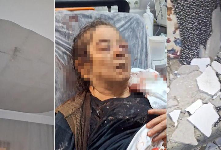 Evinde otururken üzerine tavan çöktü! 75 yaşındaki kadın görme kaybı yaşıyor